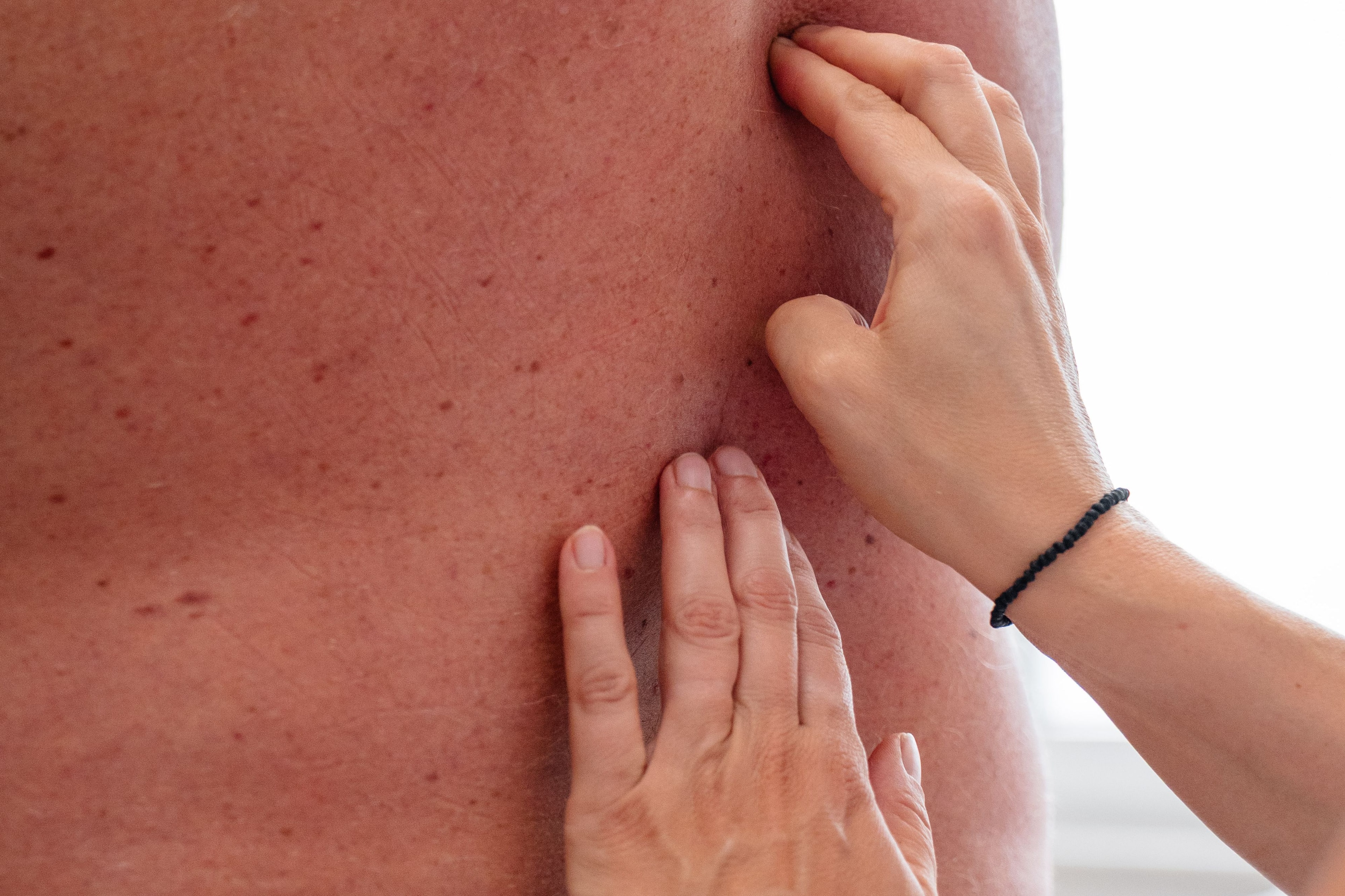 Bindegewebsmassage im Bereich des unteren Rückens im Rahmen der physiotherapeutischen Behandlung in Köln